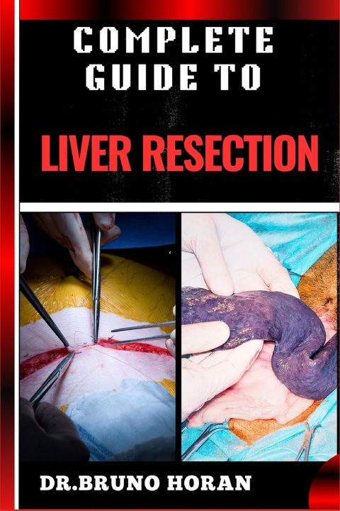 Knjiga COMPLETE GUIDE TO LIVER RESECTION DR. BRUNO HORAN