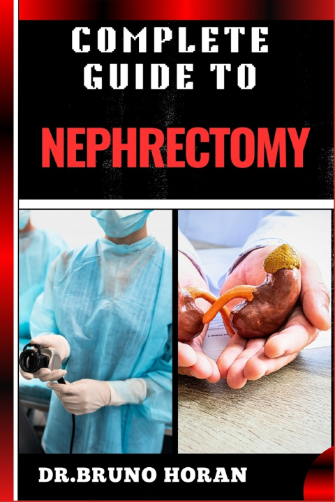 Kniha COMPLETE GUIDE TO NEPHRECTOMY DR. BRUNO HORAN