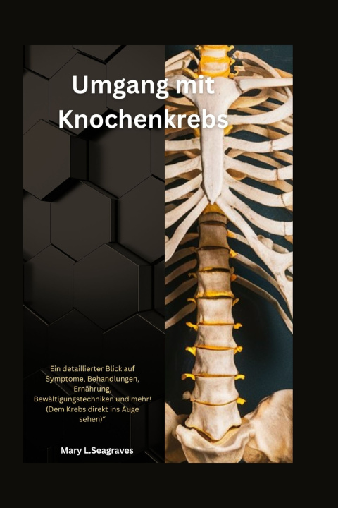 Книга Umgang mit Knochenkrebs Mary L. Seagraves