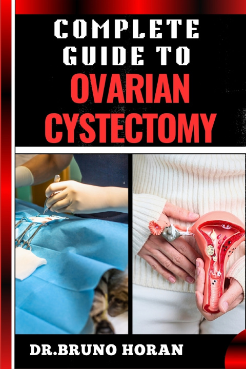 Knjiga COMPLETE GUIDE TO OVARIAN CYSTECTOMY DR. BRUNO HORAN