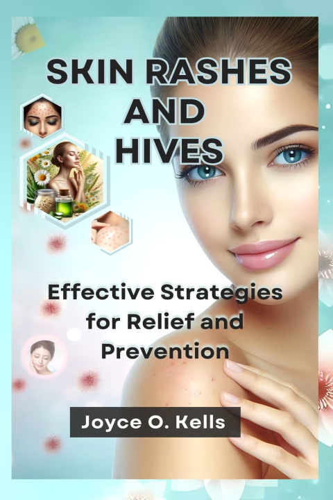 Kniha Skin Rashes and Hives Joyce O. Kells