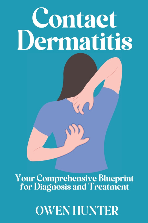 Kniha Contact Dermatitis OWEN HUNTER