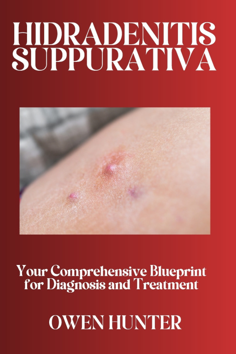 Knjiga Hidradenitis Suppurativa HUNTER