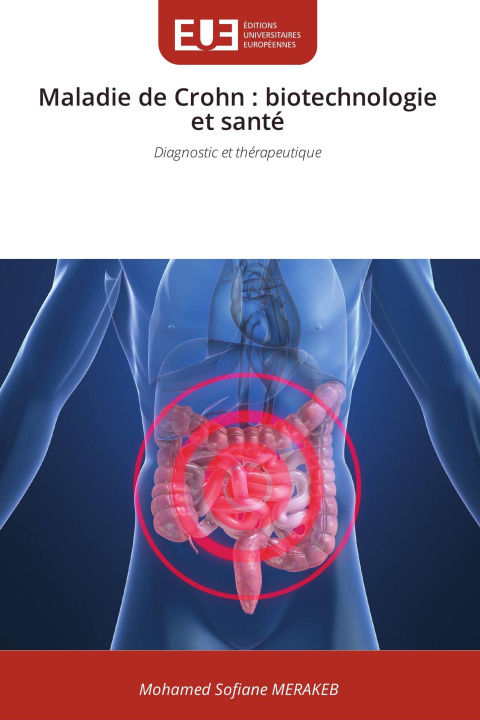 Knjiga Maladie de Crohn Mohamed Sofiane MERAKEB