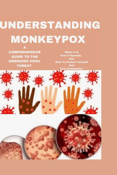 Kniha Understanding Monkeypox DR. AVA SINCLEAR