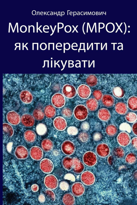 Kniha MonkeyPox (MPOX) Олександ Герасимович