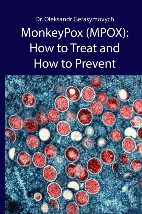 Kniha MonkeyPox (MPOX) Oleksandr Gerasymovych