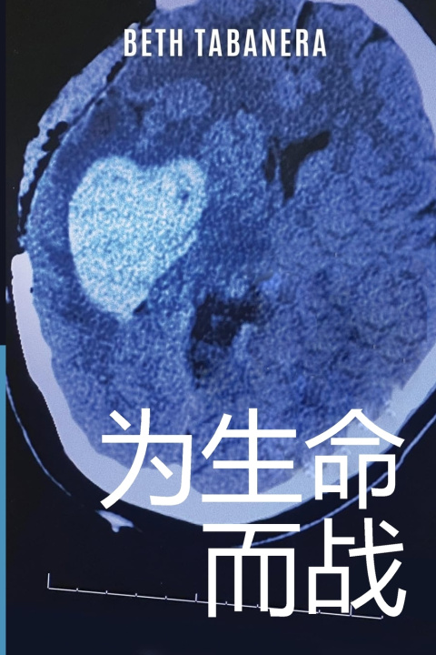 Knjiga 为生命而战 Beth Tabanera