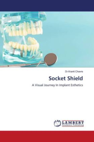 Knjiga Socket Shield Dr.Kranti Chavre