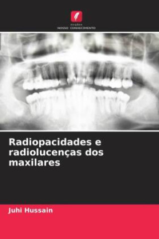 Libro Radiopacidades e radiolucenças dos maxilares Juhi Hussain