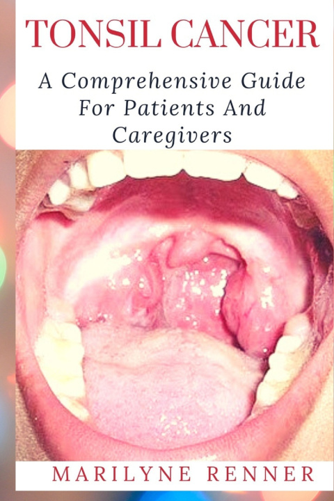 Book TONSIL CANCER Marilyne Renner