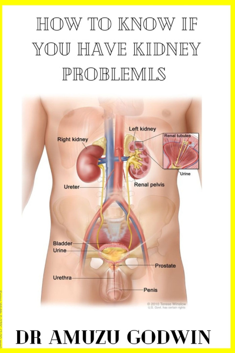 Книга How to know if you have kidney problem Amuzu Godwin