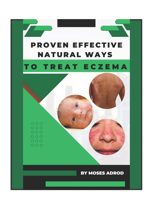 Kniha PROVEN EFFECTIVE NATURAL WAYS TO TREAT ECZEMA Moses Adrod