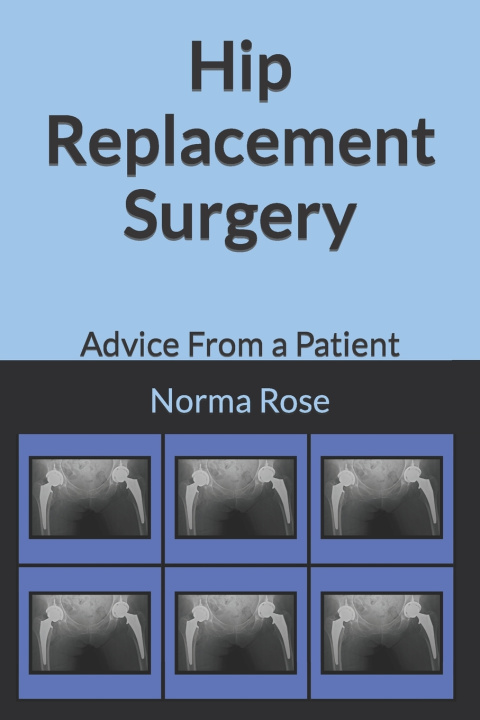 Knjiga Hip Replacement Surgery Norma Rose