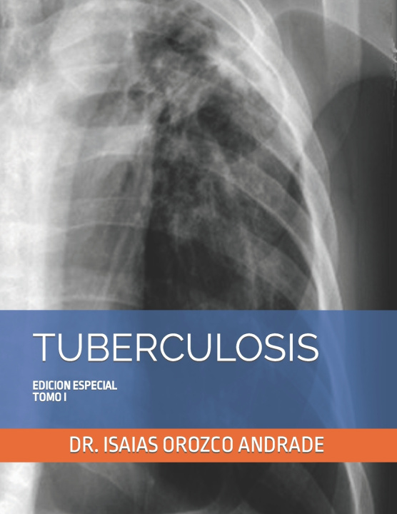 Kniha TUBERCULOSIS ISAIAS OROZCO ANDRADE