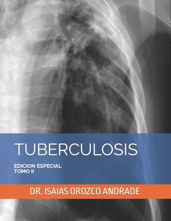 Kniha TUBERCULOSIS ISAIAS OROZCO ANDRADE