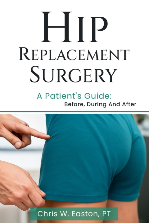 Kniha Hip Replacement Surgery Chris W. Easton