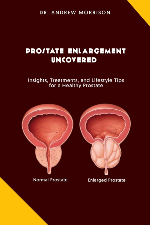 Kniha PROSTRATE ENLARGEMENT UNCOVERED Dr. Andrew Morrison