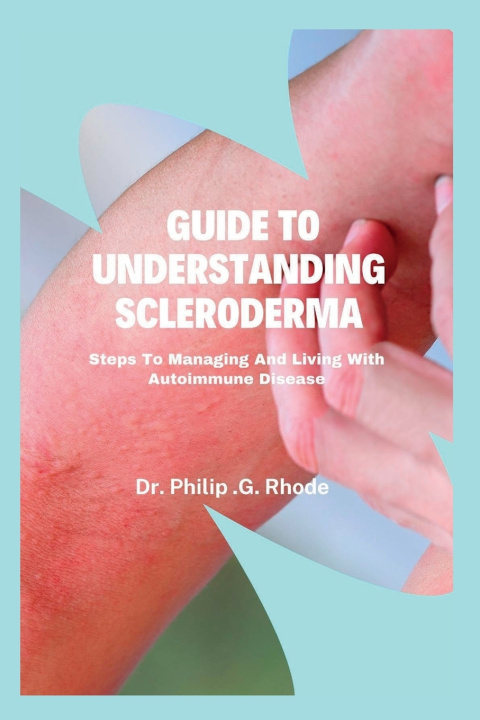 Kniha Guide to Understanding Scleroderma Dr. Philip.G. Rhode