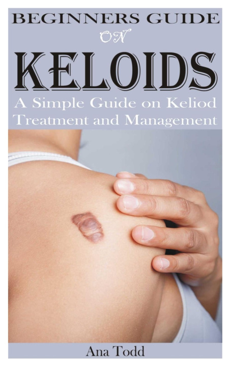 Knjiga BEGINNERS GUIDE ON KELOIDS Ana Todd