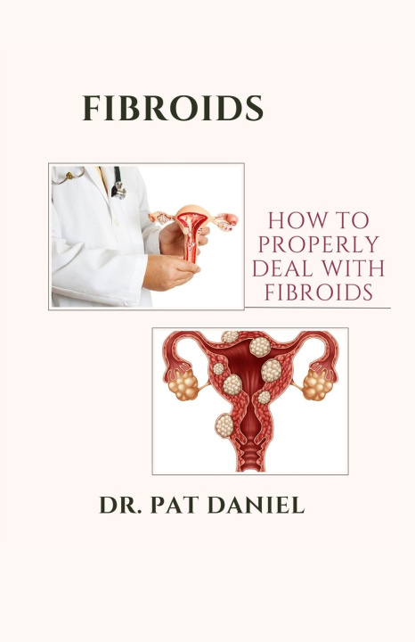 Kniha FIBROIDS DR. PAT DANIEL