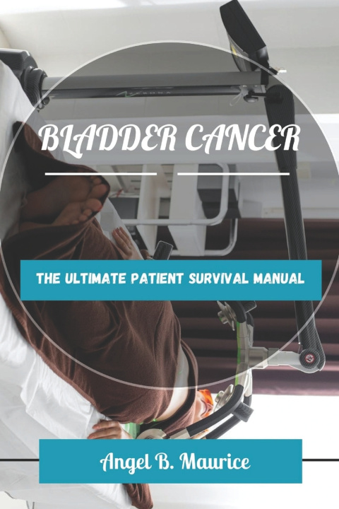 Knjiga BLADDER CANCER Angel B. Maurice