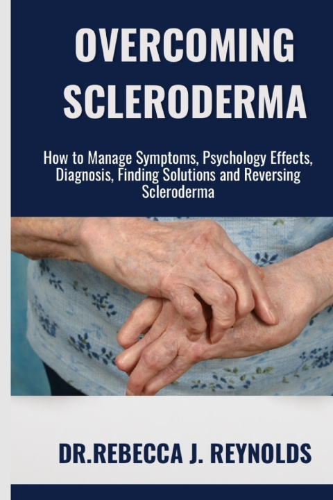Kniha OVERCOMING SCLERODERMA Dr.Rebecca J. Reynolds
