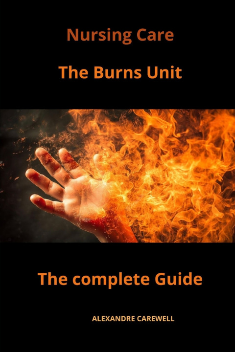 Knjiga Nursing Care The Burns Unit The complete Guide ALEXANDRE CAREWELL