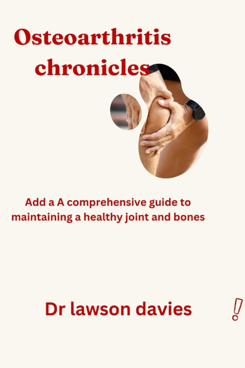 Kniha Osteoarthritis chronicles Dr lawson Davies