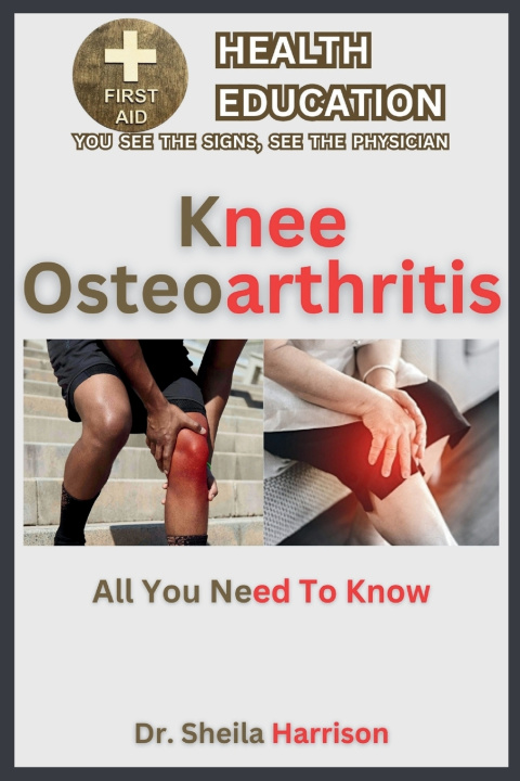 Kniha Knee Osteoarthritis Sheila Harrison