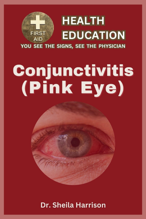Book Pink Eye (Conjunctivitis) Dr. Sheila Harrison