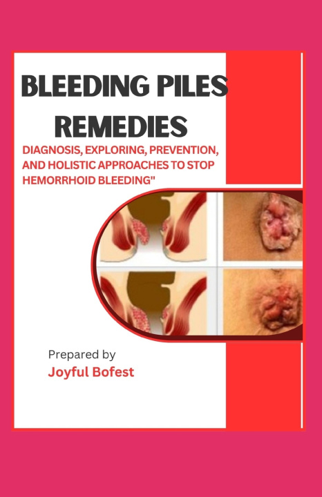 Knjiga BLEEDING PILES REMEDIES JOYFUL BOFEST