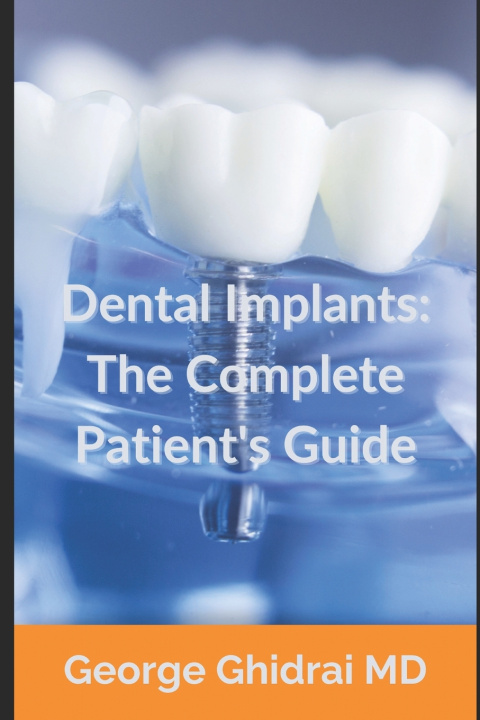 Carte Dental Implants George Ghidrai MD