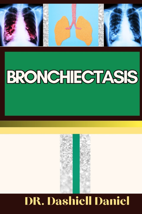 Knjiga BRONCHIECTASIS DR. DASHIELL DANIEL