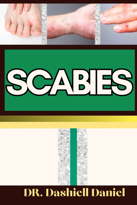 Book SCABIES DR. DASHIELL DANIEL