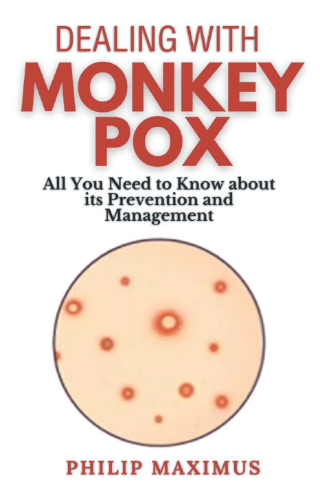 Kniha Dealing with MonkeyPox Philip Maximus