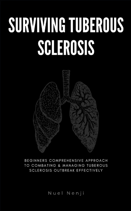 Kniha SURVIVING TUBEROUS SCLEROSIS Nuel Nenji