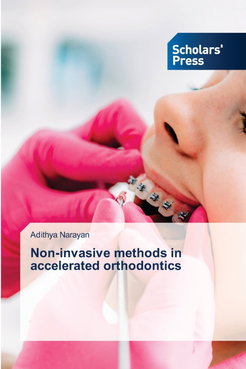 Book Non-invasive methods in accelerated orthodontics Adithya Narayan