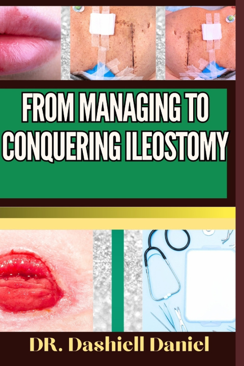 Książka FROM MANAGING TO CONQUERING ILEOSTOMY DR. DASHIELL DANIEL