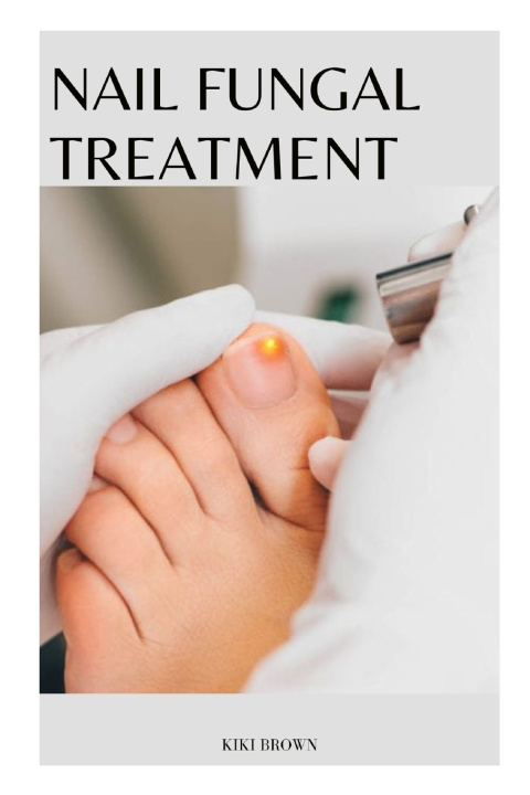 Knjiga NAIL FUNGAL TREATMENT KIKI BROWN