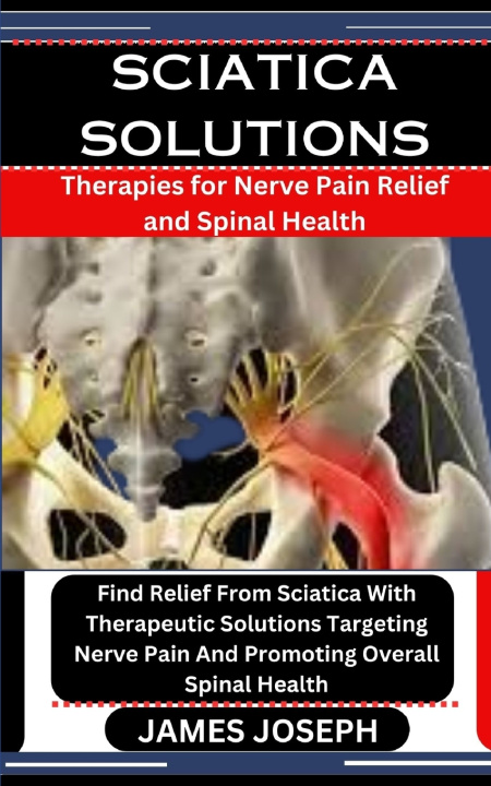 Kniha SCIATICA SOLUTIONS JAMES JOSEPH