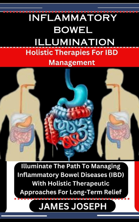 Kniha INFLAMMATORY BOWEL ILLUMINATION JAMES JOSEPH