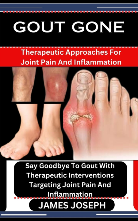 Książka GOUT GONE JAMES JOSEPH