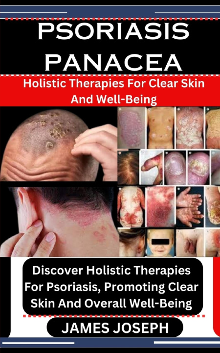 Book PSORIASIS PANACEA JAMES JOSEPH