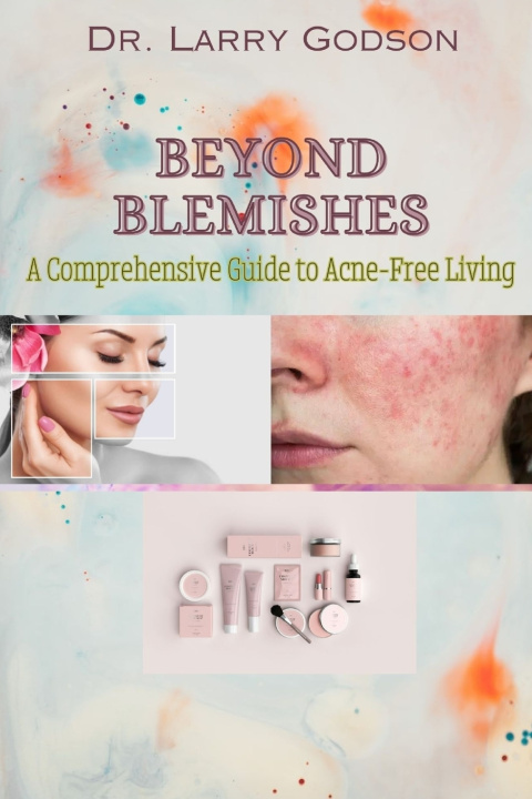Książka BEYOND BLEMISHES Dr. Larry Godson