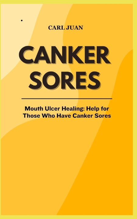 Kniha CANKER SORES CARL JUAN