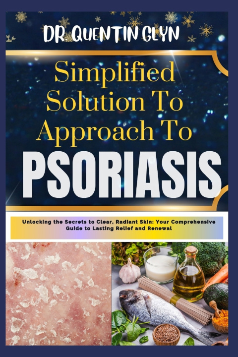 Knjiga Simplified Solution Approach To PSORIASIS Dr QUENTIN GLYN