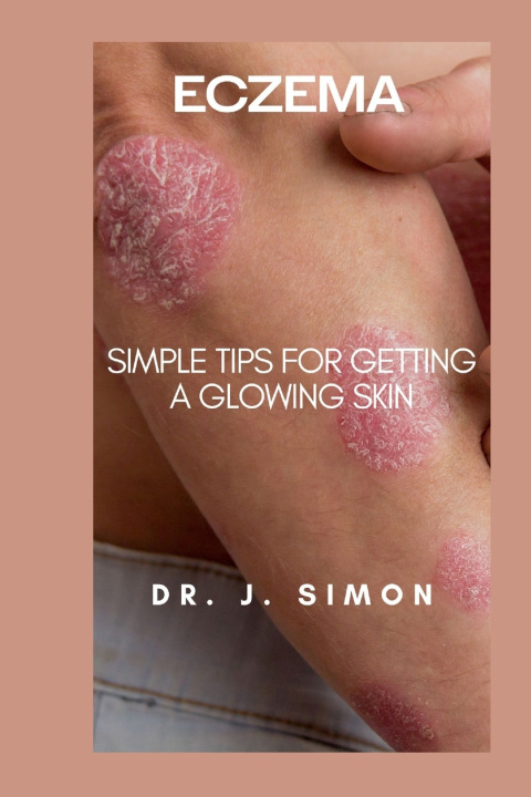 Kniha ECZEMA DR. J. SIMON
