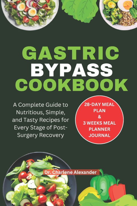 Knjiga Gastric Bypass Cookbook Dr. Charlene Alexander