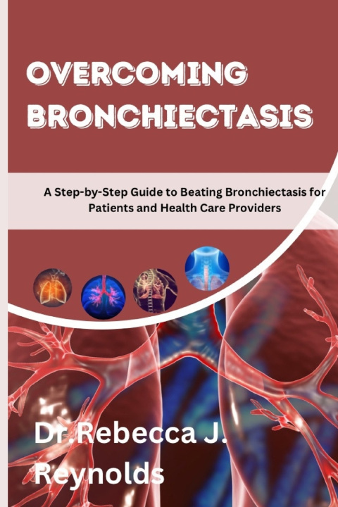 Kniha Overcoming Bronchiectasis Rebecca J. Reynolds